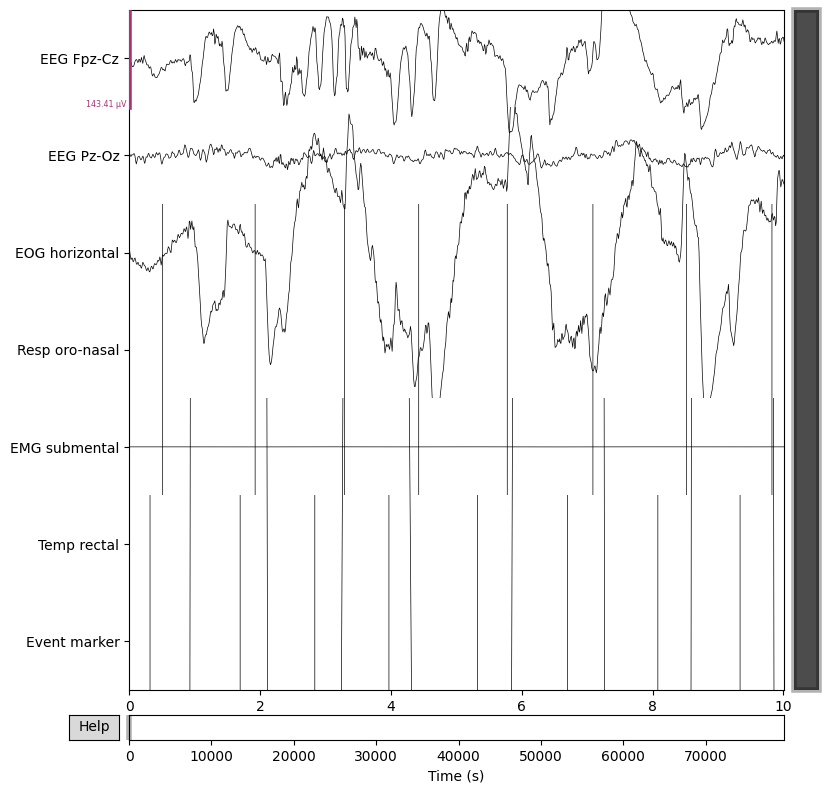 EEG Alarm Optimizer App image 7